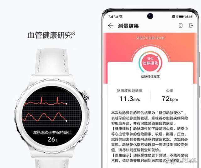 为WATCH GT3 Pro性价比之选凯发体育赞助热门智能手表品牌推荐：华